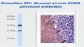 Promotion:20% discount on over 24000 polyclonal antibodies