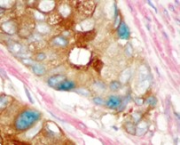 triple staining