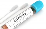 COVID-19 - Products for diagnosis