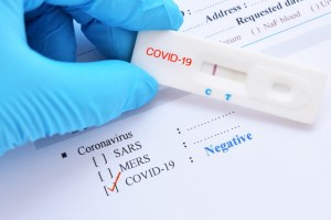 Sars Cov 2 Covid 19 Diagnosis By Igg Igm Rapid Test Anawa